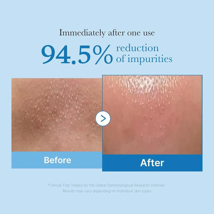 MEDICUBE Zero Pore Blackhead Deep Cleansing Oil 205 ML - DOKAN