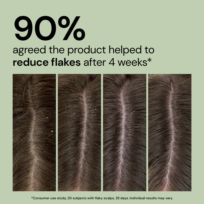 Before and after - four close-up photos of a scalp part comparison showing "90% agreed the product helped to reduce flakes after 4 weeks*"

*Consumer use study, 20 subjects with flaky scalps, 28 days. Individual results may vary"