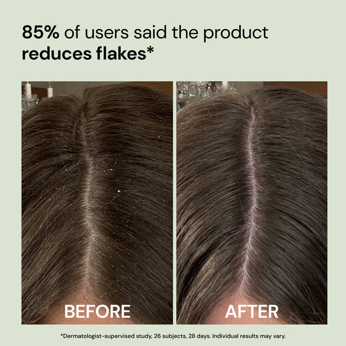 Before and after part comparison showing "85% of users said the product reduces flakes*"

*Dermatologist-supervised stud, 26 subjects, 28 days. Individual results may vary