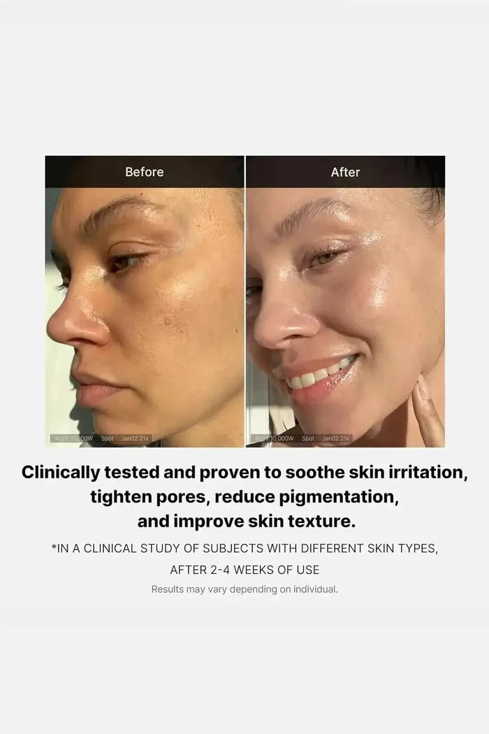 Before and after comparison showing visible improvements, validating it as the best firming face cream for sagging skin.