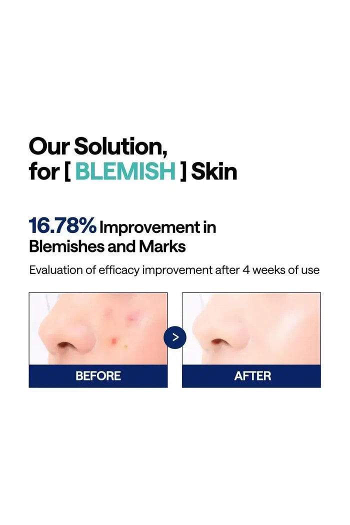 Before and after results showing significant blemish and skin tone improvement after 2 weeks of using the Madecassoside infused toner pads.