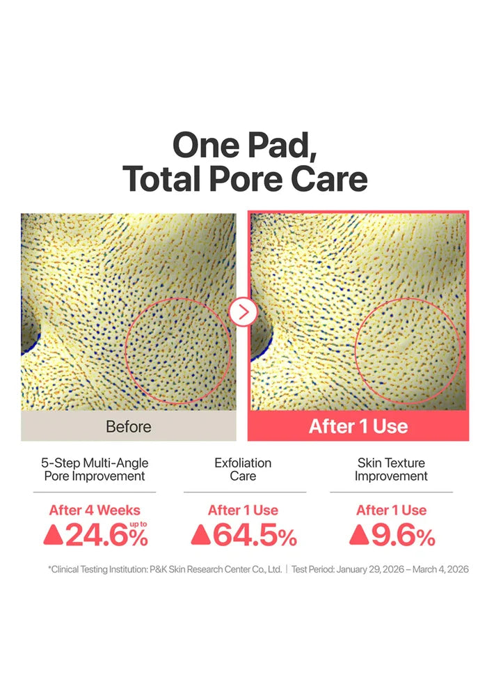 Before and after effect of a pore care product on skin texture with statistical improvements.